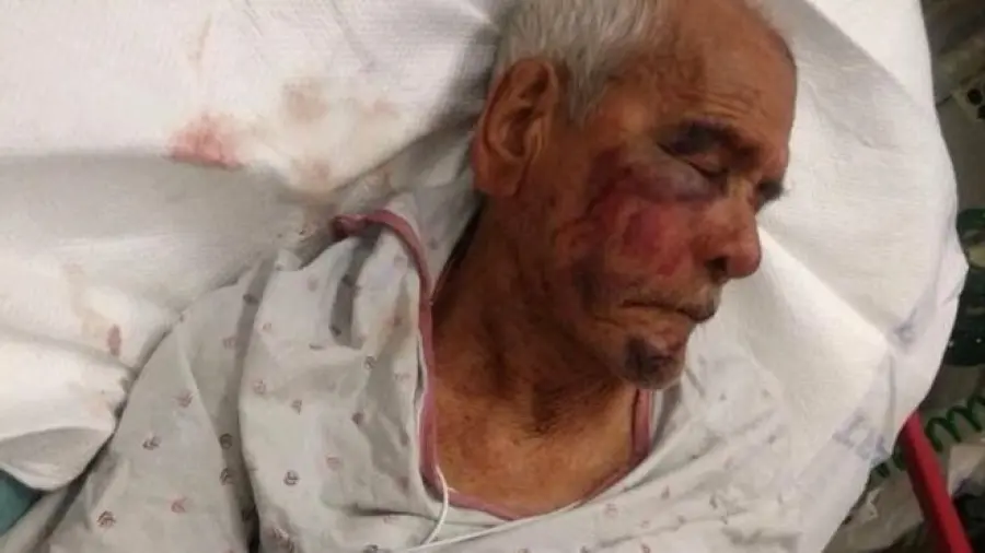 Anziano malmenato, "Torna in Messico"