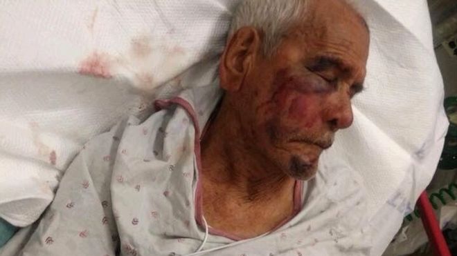 Anziano malmenato, "Torna in Messico"